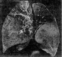 女人张开腿让男人添